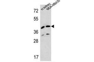 Western blot analysis in MDA-MB435 cell line and mouse kidney tissue lysates (35ug/lane) using L2HGDH/Duranin Antibody .