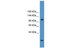 Clcn1 antibody used at 5 ug/ml to detect target protein. (CLCN1 antibody  (C-Term))
