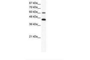 Image no. 1 for anti-Annexin A6 (ANXA6) (AA 28-77) antibody (ABIN203241) (ANXA6 antibody  (AA 28-77))