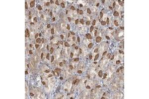 Immunohistochemical staining of human stomach with TBC1D5 polyclonal antibody  shows moderate cytoplasmic positivity in parietal cells.