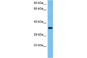 Western Blotting (WB) image for anti-Wingless-Type MMTV Integration Site Family, Member 4 (WNT4) (Middle Region) antibody (ABIN2779469)
