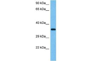 Host:  Mouse  Target Name:  WNT4  Sample Tissue:  Mouse Testis  Antibody Dilution:  1ug/ml (WNT4 antibody  (Middle Region))