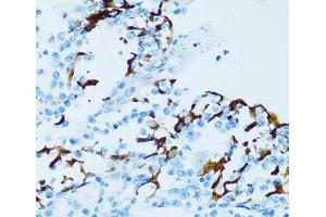 Immunohistochemistry of paraffin-embedded Human tonsil using CTSE Polyclonal Antibody at dilution of 1:100 (40x lens).