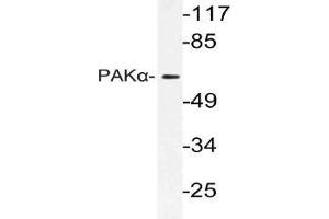 Western blot (WB) analysis of PAKalpha antibody in extracts from 3T3 cells. (PAK1 antibody)