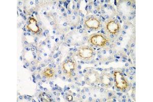 Immunohistochemistry of paraffin-embedded Rat kidney using RARRES2 Polyclonal Antibody at dilution of 1:200 (40x lens). (Chemerin antibody)