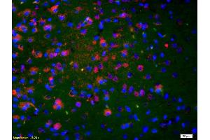 Formalin-fixed and paraffin-embedded rat brain labeled with Anti-NKA/Neurokinin A Polyclonal Antibody, Unconjugated (ABIN724445) 1:200, overnight at 4°C, The secondary antibody was Goat Anti-Rabbit IgG, Cy3 conjugated used at 1:200 dilution for 40 minutes at 37°C.