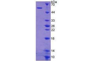 Image no. 1 for Kallikrein 1 (KLK1) (AA 27-261) protein (His tag,GST tag) (ABIN6237702) (Kallikrein 1 Protein (KLK1) (AA 27-261) (His tag,GST tag))