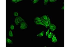 Immunofluorescent analysis of HepG2 cells using ABIN7168481 at dilution of 1:100 and Alexa Fluor 488-congugated AffiniPure Goat Anti-Rabbit IgG(H+L) (RUNX1 antibody  (AA 211-445))