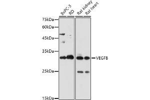 Western blot analysis of extracts of various cell lines, using VEGFB antibody (ABIN7271298) at 1:1000 dilution. (VEGFB antibody  (AA 25-207))