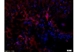 Formalin-fixed and paraffin-embedded rat liver labeled with Anti-NGFR/p75NTR Polyclonal Antibody, Unconjugated (ABIN725660) 1:200, overnight at 4°C, The secondary antibody was Goat Anti-Rabbit IgG, PE conjugated used at 1:200 dilution for 40 minutes at 37°C. (NGFR antibody  (AA 301-400))
