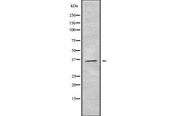 GIMAP7 antibody  (N-Term)
