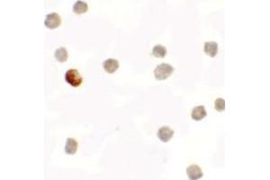 Immunocytochemistry of SDHAF1 in 3T3 cells with SDHAF1 antibody at 5 ug/mL. (SDHAF1 antibody  (C-Term))
