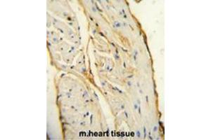 AIF1 antibody (N-term) immunohistochemistry analysis in formalin fixed and paraffin embedded mouse heart tissue followed by peroxidase conjugation of the secondary antibody and DAB staining. (Iba1 antibody  (N-Term))