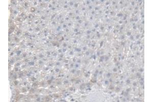 Detection of CES1 in Rat Liver Tissue using Polyclonal Antibody to Carboxylesterase 1 (CES1) (CES1 antibody  (AA 19-300))