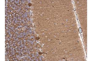 IHC-P Image Aldolase A antibody detects Aldolase A protein at cytosol on rat hind brain by immunohistochemical analysis. (ALDOA antibody)