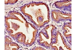 Immunohistochemistry of paraffin-embedded human prostate tissue using ABIN7157208 at dilution of 1:100 (Kallikrein 2 antibody  (AA 25-261))