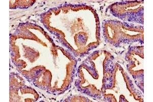 Immunohistochemistry of paraffin-embedded human prostate tissue using ABIN7157208 at dilution of 1:100 (Kallikrein 2 antibody  (AA 25-261))