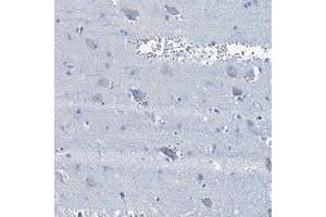 Immunohistochemical staining of human lateral ventricle with BFSP2 polyclonal antibody  shows weak cytoplasmic positivity in neuronal cells.