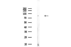 Western blot analysis of lysates from COLO205 cells, using CDH7 Antibody at 1/1000 dilution.