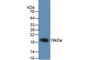 Figure. (RANKL antibody  (AA 106-240))