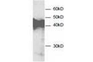 Image no. 1 for anti-Annexin A3 (ANXA3) antibody (ABIN791545) (Annexin A3 antibody)