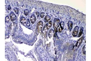 IHC analysis of EGF using anti-EGF antibody . (EGF antibody  (AA 974-1026))