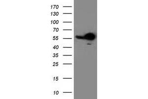 HEK293T cells were transfected with the pCMV6-ENTRY control (Left lane) or pCMV6-ENTRY RBBP7 (Right lane) cDNA for 48 hrs and lysed. (RBBP7 antibody)
