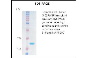 SDS-PAGE (SDS) image for Colony Stimulating Factor 3 (Granulocyte) (CSF3) (Active) protein (ABIN5509310)