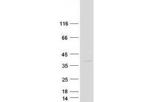 Validation with Western Blot (COMMD8 Protein (Myc-DYKDDDDK Tag))