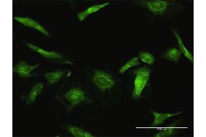 Immunofluorescence of purified MaxPab antibody to USP10 on HeLa cell. (USP10 antibody  (AA 1-798))