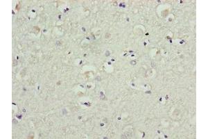 Immunohistochemistry of paraffin-embedded human brain tissue using ABIN7145267 at dilution of 1:100 (BATF2 antibody  (AA 1-189))