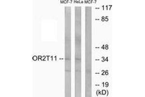 OR2T11 antibody  (AA 51-100)
