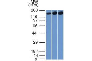 Western Blotting (WB) image for anti-Topoisomerase (DNA) II alpha 170kDa (TOP2A) (AA 1352-1493) antibody (ABIN6940773)