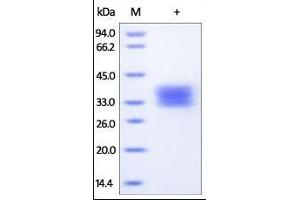 Human TNFR1, His Tag on SDS-PAGE under reducing (R) condition.