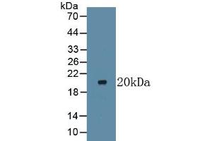 Detection of Recombinant LTbR, Human using Monoclonal Antibody to Lymphotoxin Beta Receptor (LTbR) (LTBR antibody  (AA 66-215))