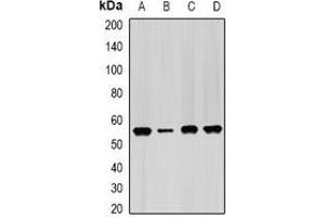 Western blot analysis of IMPDH2 expression in Hela (A), PC3 (B), mouse spleen (C), mouse heart (D) whole cell lysates. (IMPDH2 antibody)