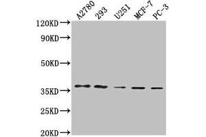 Western Blot Positive WB detected in: A2780 whole cell lysate, 293 whole cell lysate, U251 whole cell lysate, MCF-7 whole cell lysate, PC-3 whole cell lysate All lanes: PDCL3 antibody at 1:2000 Secondary Goat polyclonal to rabbit IgG at 1/50000 dilution Predicted band size: 28 kDa Observed band size: 37 kDa (PDCL3 antibody  (AA 1-239))