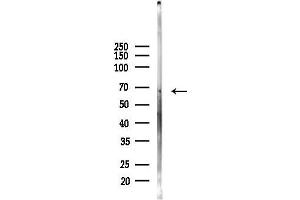 anti-Adenosylhomocysteinase-Like 2 (AHCYL2) antibody