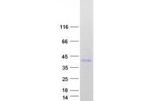 Western Blotting (WB) image for Estrogen Receptor Binding Site Associated, Antigen, 9 (EBAG9) (Transcript Variant 2) protein (Myc-DYKDDDDK Tag) (ABIN2719905)