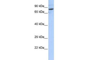 WB Suggested Anti-SPTLC2 Antibody Titration:  0. (SPTLC2 antibody  (N-Term))