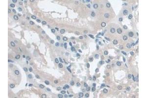 IHC-P analysis of Rat Kidney Tissue, with DAB staining. (Butyrylcholinesterase antibody  (AA 345-570))