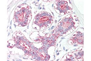Anti-MAGEA1 / MAGE 1 antibody IHC of human breast. (MAGEA1 antibody  (AA 38-87))