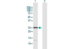 Western Blot analysis of ITGB1BP3 expression in transfected 293T cell line by ITGB1BP3 MaxPab polyclonal antibody. (ITGB1BP3 antibody  (AA 1-230))