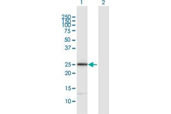ITGB1BP3 抗体  (AA 1-230)