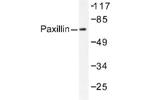Image no. 2 for anti-Paxillin (PXN) antibody (ABIN271779) (Paxillin antibody)