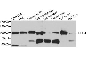 Western blot analysis of extracts of various cell lines, using DLG4 antibody. (DLG4 antibody)