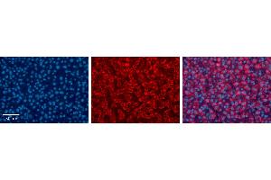 UGT1A6 antibody - C-terminal region          Formalin Fixed Paraffin Embedded Tissue:  Human Liver Tissue    Observed Staining:  Cytoplasm in hepatocytes   Primary Antibody Concentration:  1:100    Other Working Concentrations:  1/600    Secondary Antibody:  Donkey anti-Rabbit-Cy3    Secondary Antibody Concentration:  1:200    Magnification:  20X    Exposure Time:  0. (UGT1A6 antibody  (C-Term))