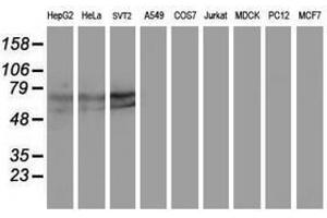 Image no. 3 for anti-Kelch-Like ECH-Associated Protein 1 (KEAP1) antibody (ABIN1499016) (KEAP1 antibody)