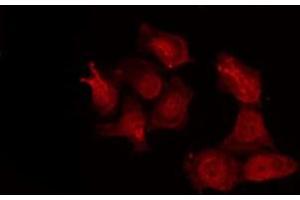 ABIN6277264 staining NIH-3T3 by IF/ICC. (MMP14 antibody  (C-Term))