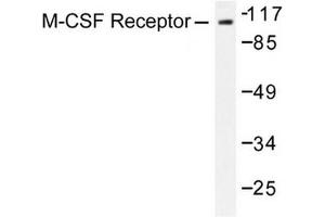 Image no. 1 for anti-Colony Stimulating Factor 1 Receptor (CSF1R) antibody (ABIN272017) (CSF1R antibody)